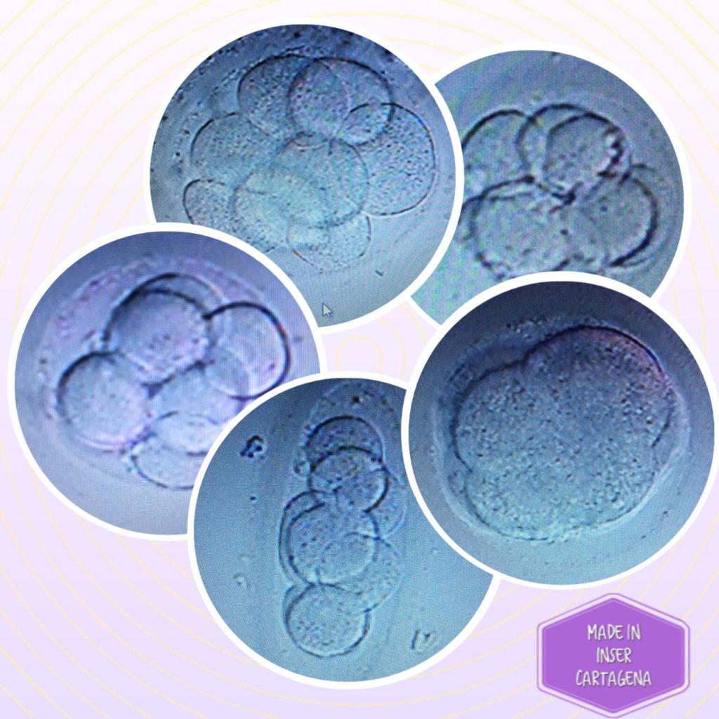 Fotografía de embriones en desarrollo tomada en laboratorio de fertilidad en Cartagena